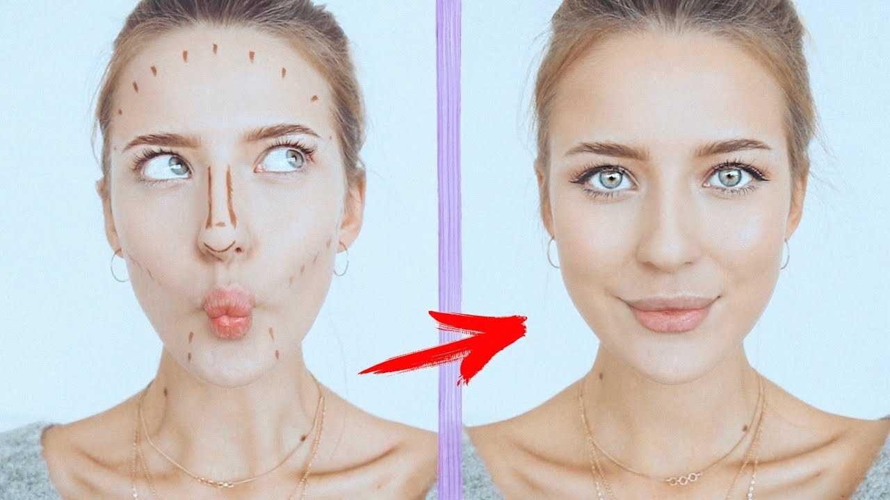 Подтяжка скул - самые эффективные методы + отзывы, фото до и после