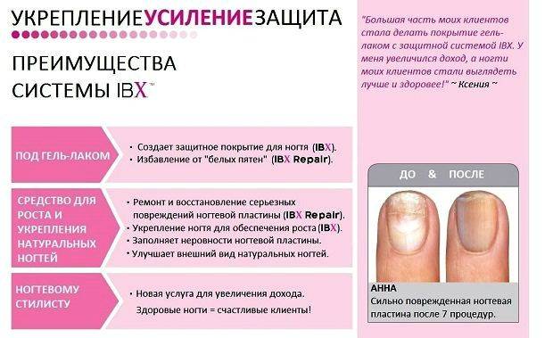 Термопленка для ногтей: что это такое и технология нанесения