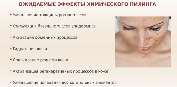 Пилинги для лица профессиональные: несколько шагов до совершенства