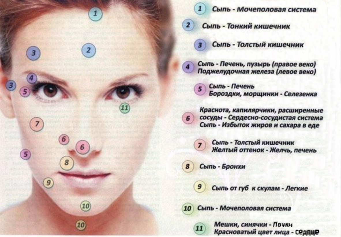 Помогите: что такое карта прыщей и можно ли по ней выявить болезни внутренних органов?
