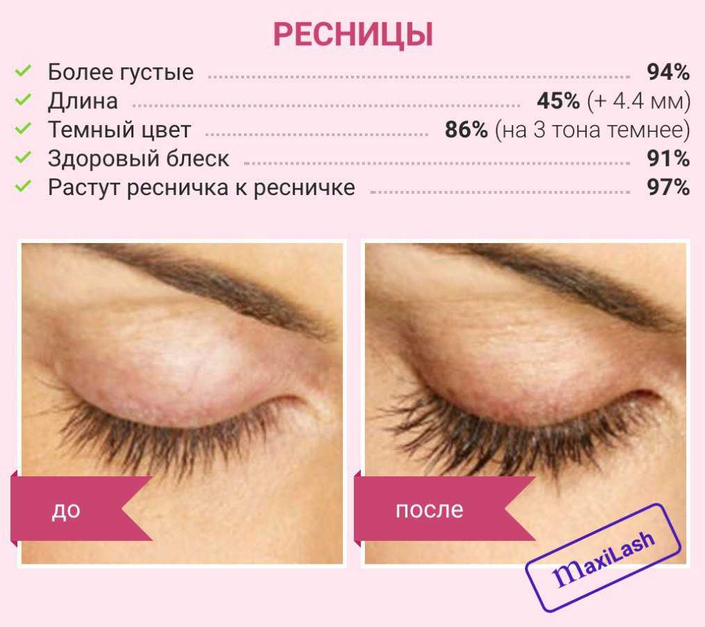 Отрастить ресницы – реально ли это? рекомендации экспертов