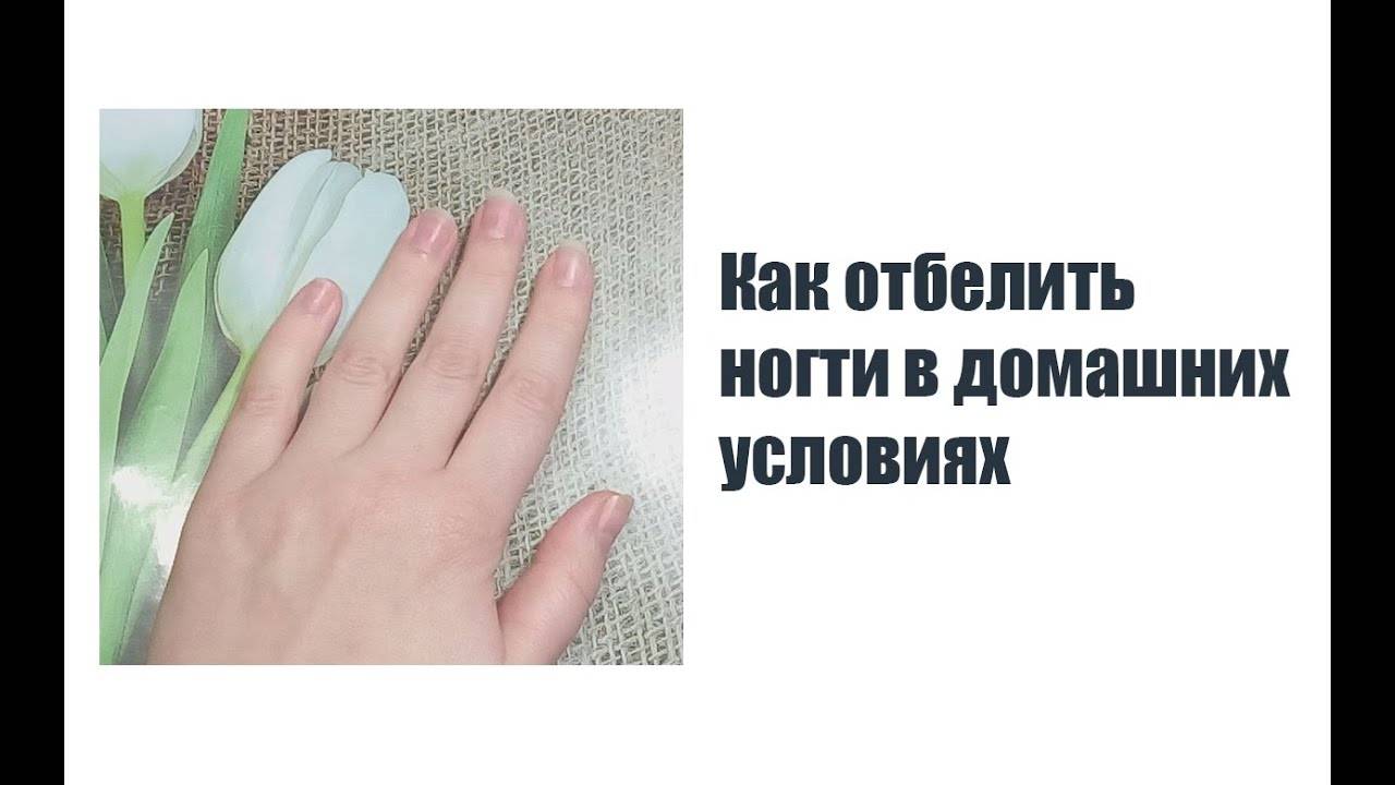3 проверенных и 3 необычных средства, чтобы отмыть руки после огорода