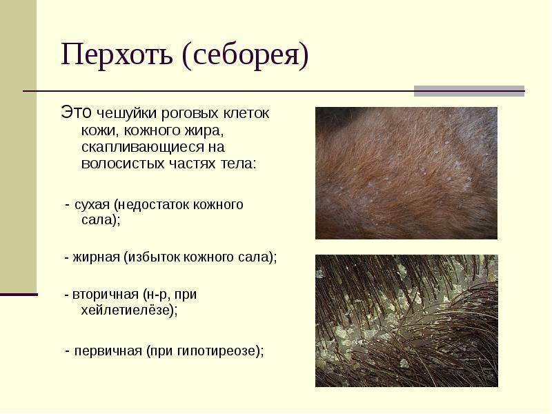 Виды перхоти на голове - клиника «доктор волос»