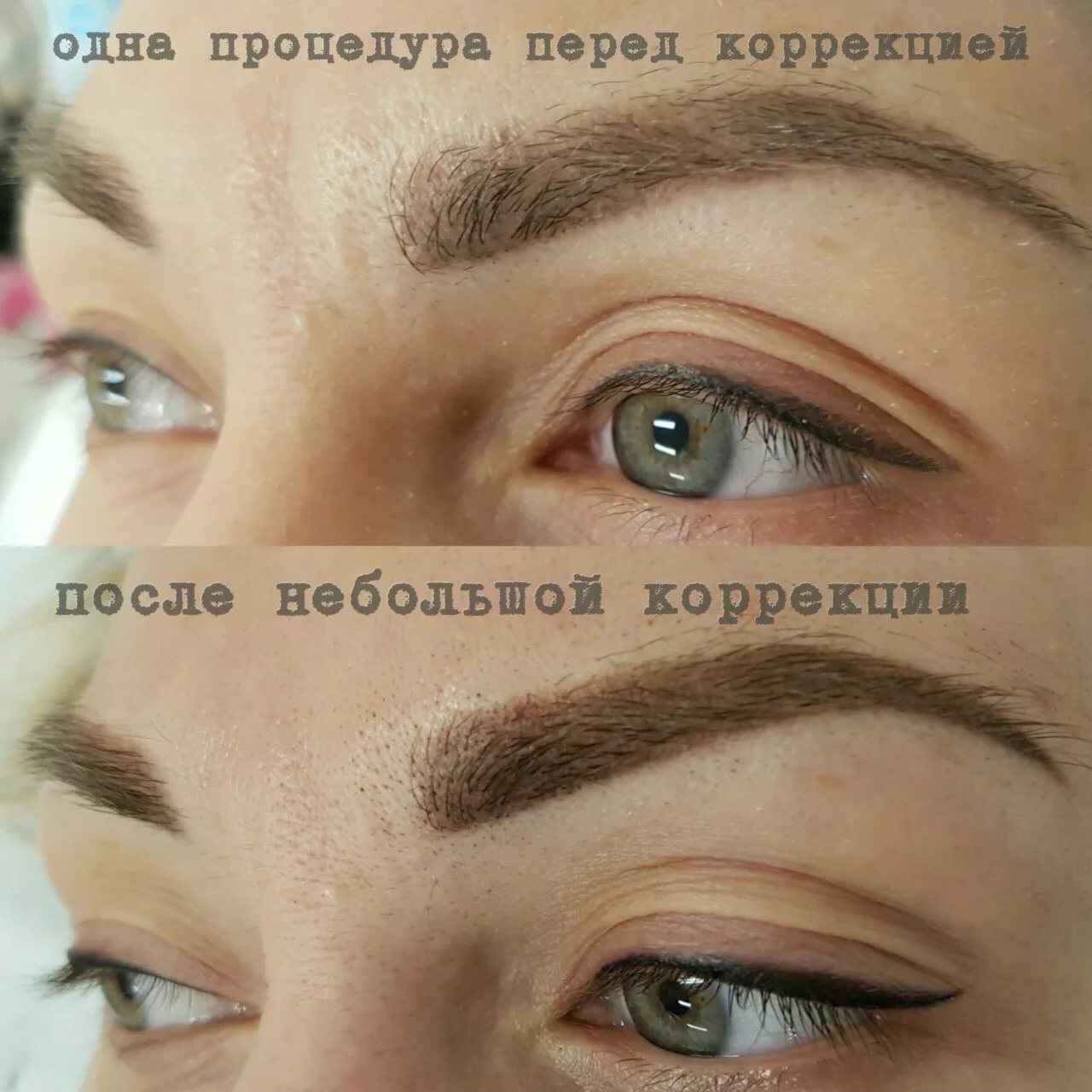 Неудачный татуаж бровей, способы коррекции, последствия, фото