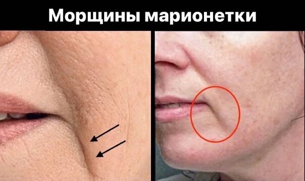 Омоложение обеденного перерыва