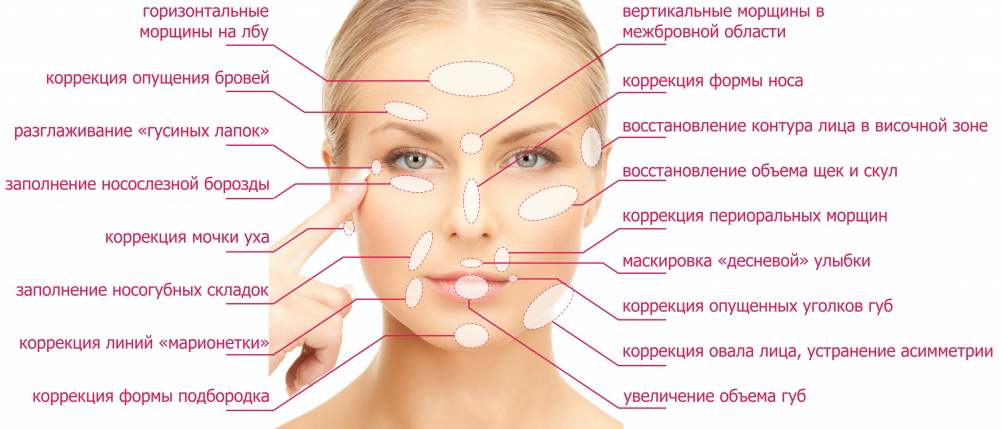 Как избавиться от филлеров