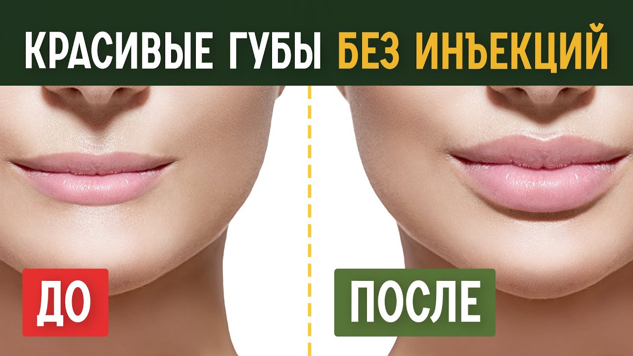 12 лучших способов увеличения губ без пластической операции – как получить губы джоли?