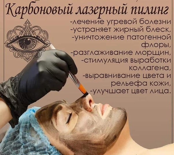 От проблемной до идеальной: лазерный карбоновый пилинг творит чудеса с кожей