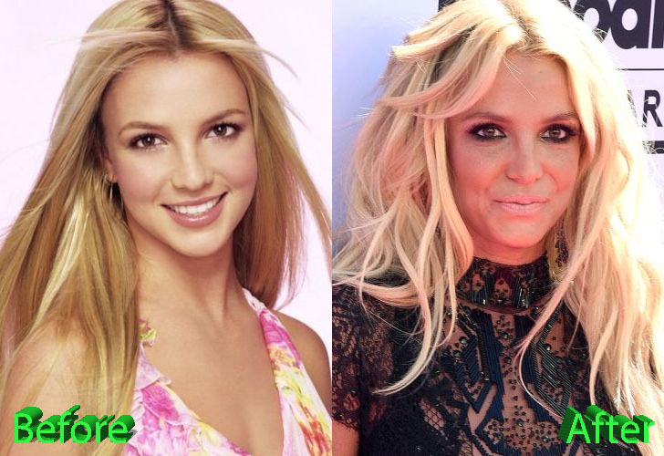 Britney spears’ new memoir changes the conversation on mental health