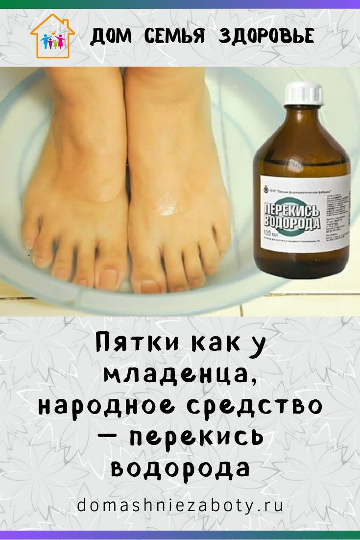 Самые распространённые методы борьбы с натоптышами: от домашнего до медицинского лечения
