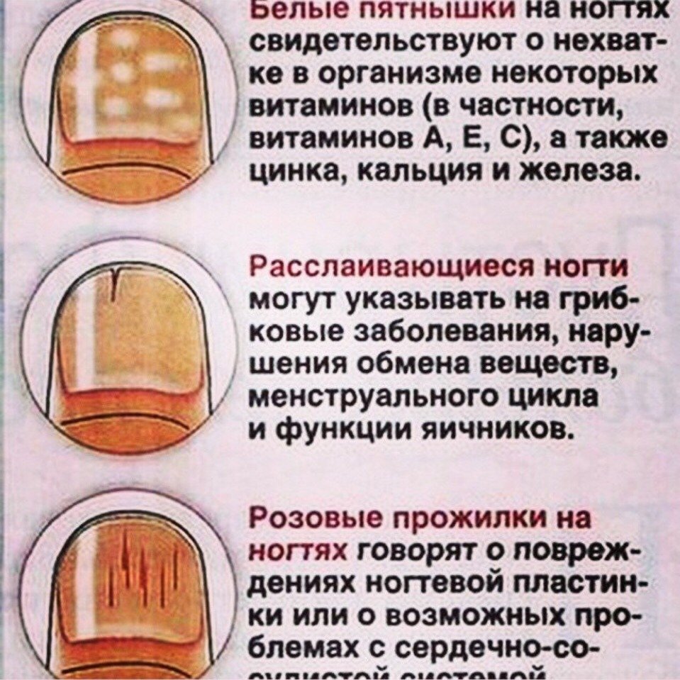 Что делать, если появились белые пятна на ногтях после шеллака? время действовать