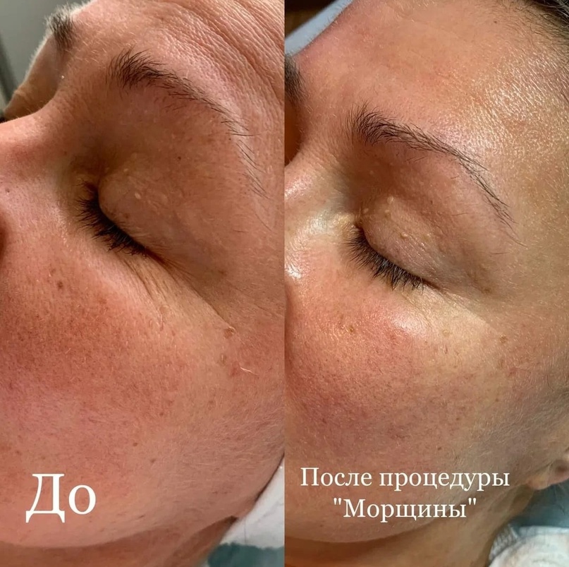 Косметика nanoasia в косметологии санкт-петербурга | dk forma