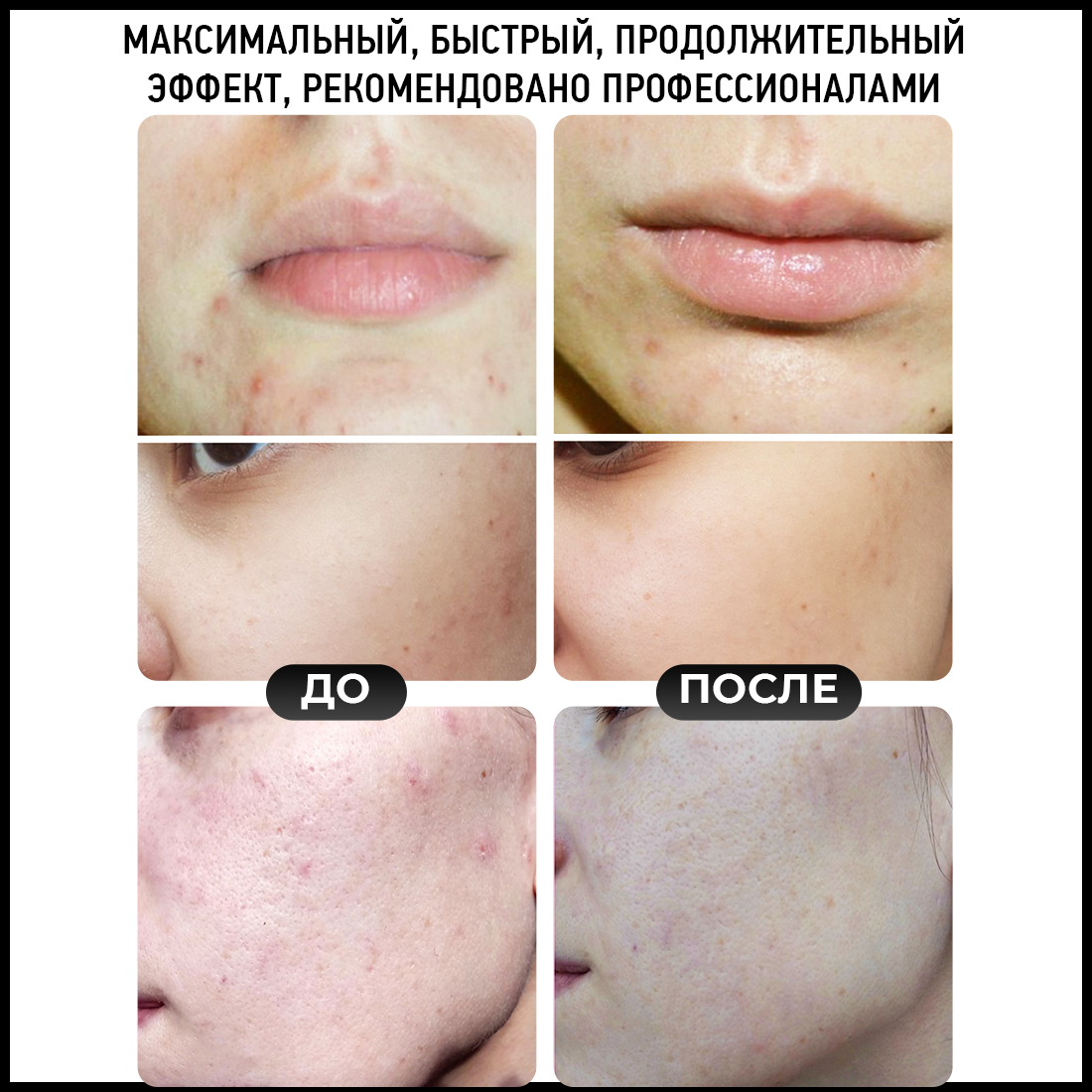 Топ 30 лучших и эффективных средств для проблемной кожи лица