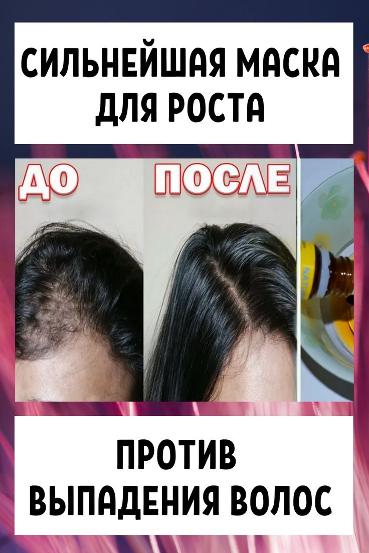 Как правильно мыть голову