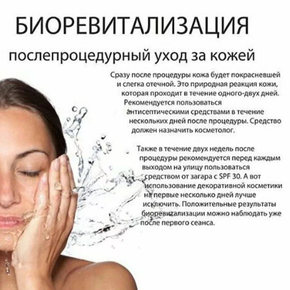 Вся правда о биоревитализации – что такое биоревитализация и кому необходима?