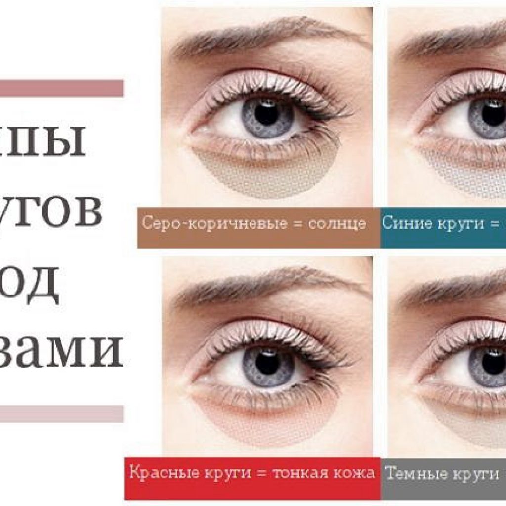 Почему появляются синяки под глазами и как от них избавиться