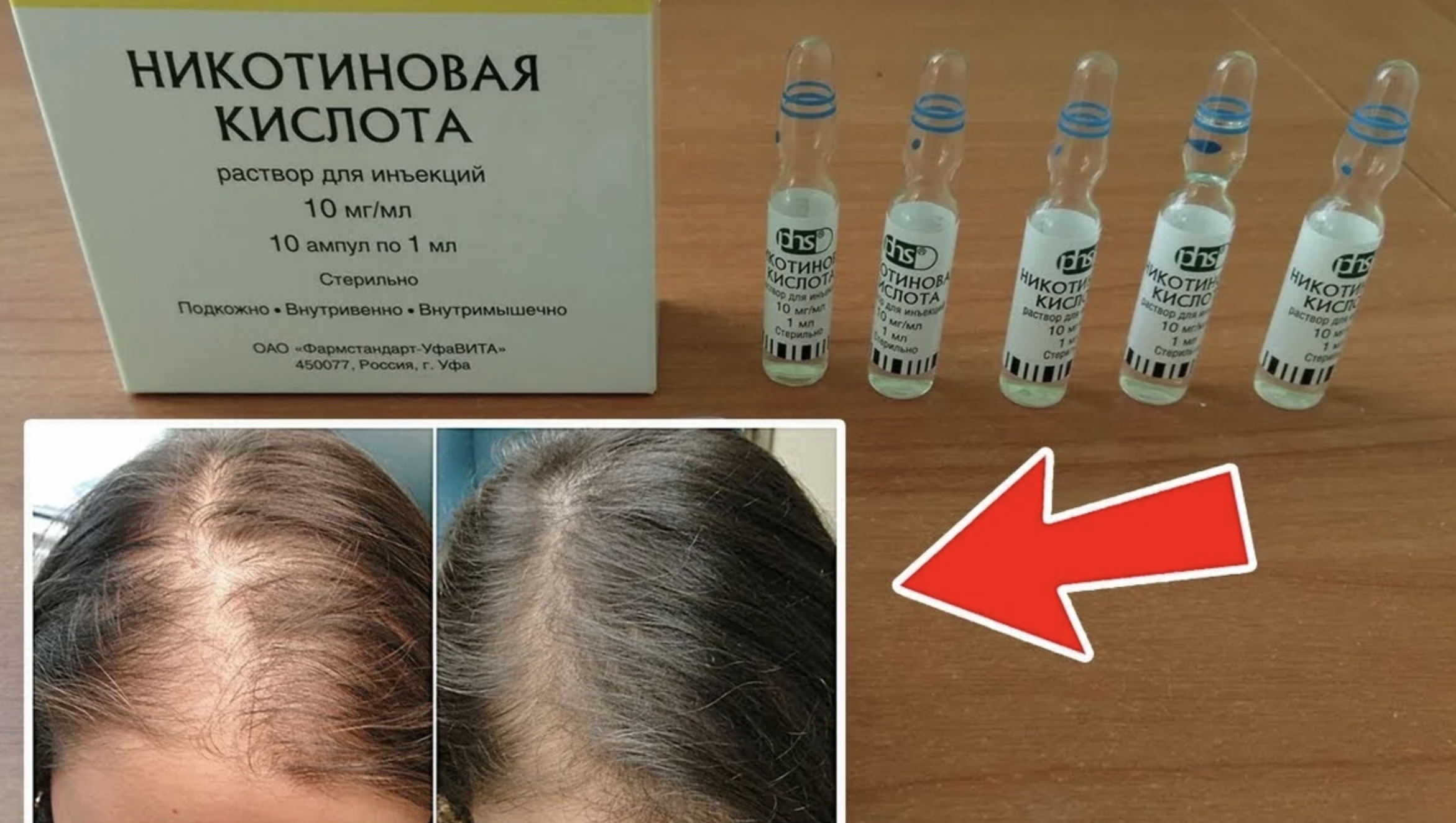 Никотиновая кислота: бешеный рост волос за копейки!