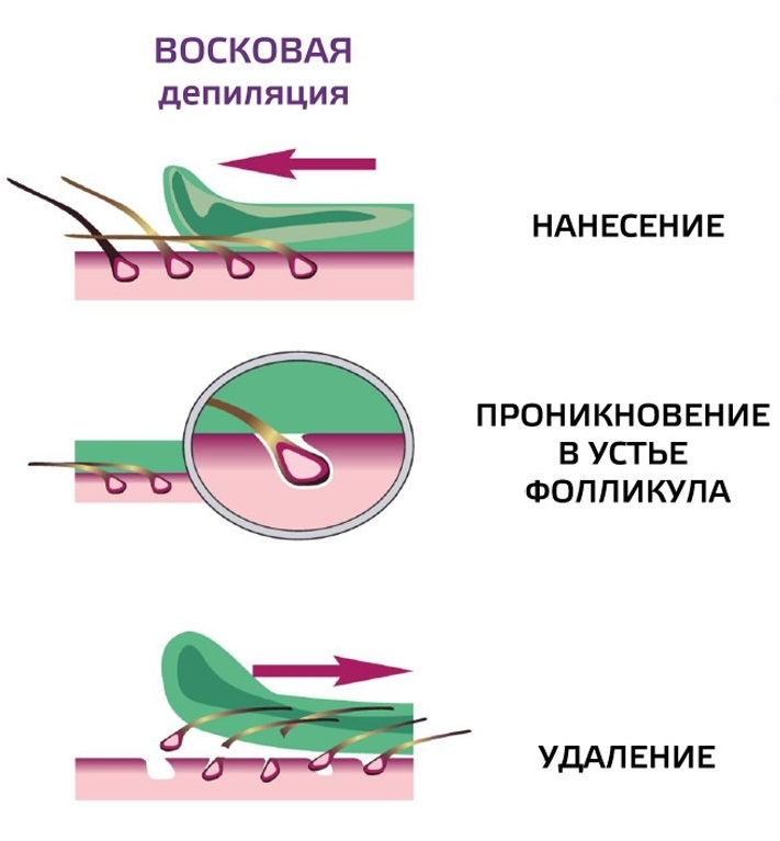 Восковая эпиляция: советы и рекомендации для начинающих