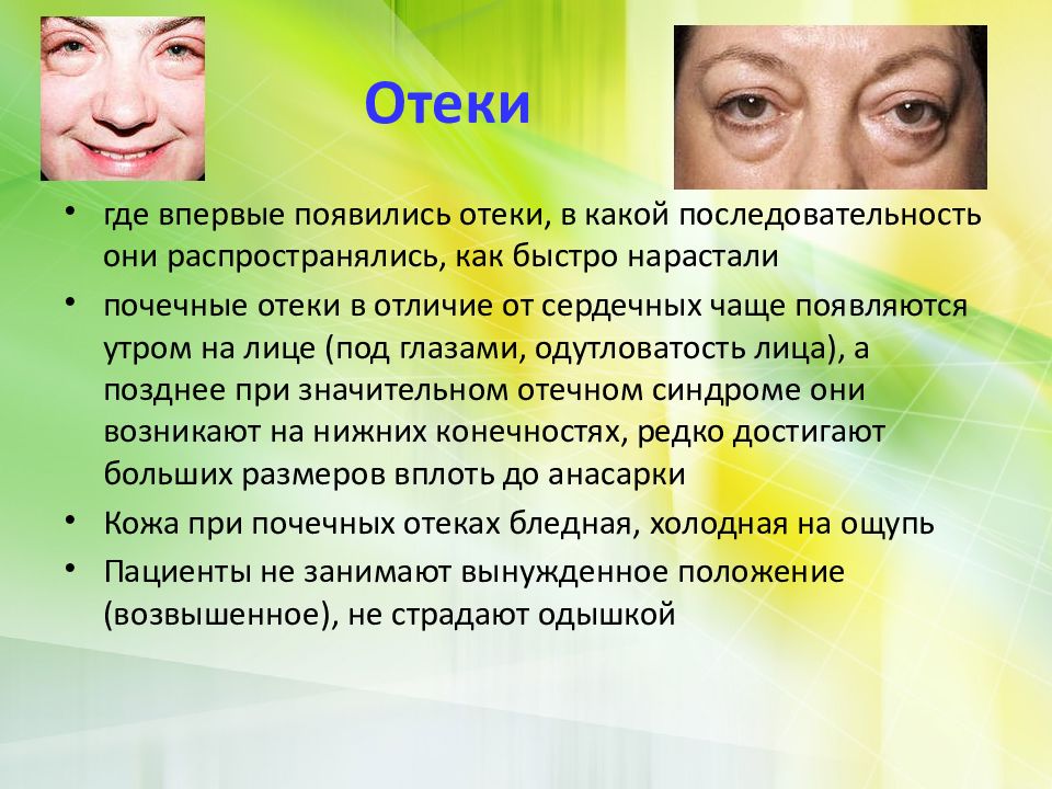 Как проснуться с утра без отеков и мешков под глазами