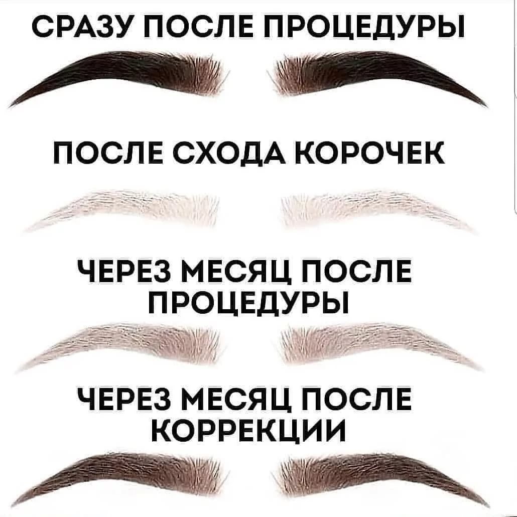 Почему появляются синяки под глазами и как от них избавиться?