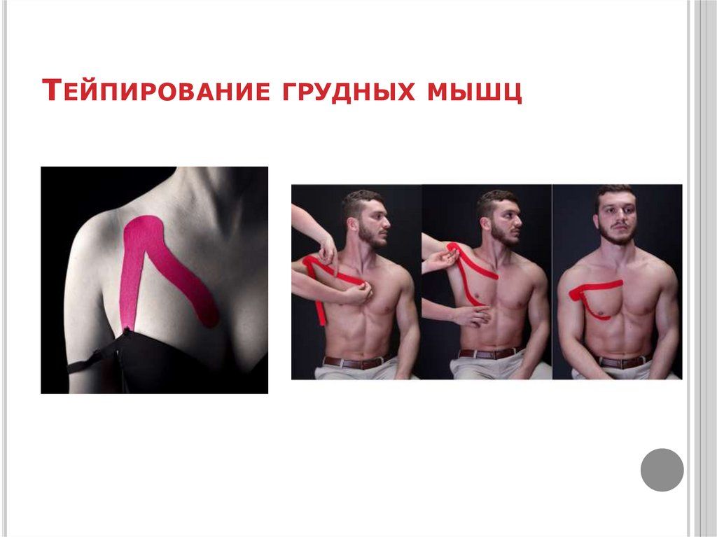 Тейпирование для похудения: схемы, отзывы