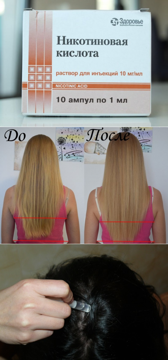 Как втирать никотиновую кислоту в волосы? | volosomanjaki.com