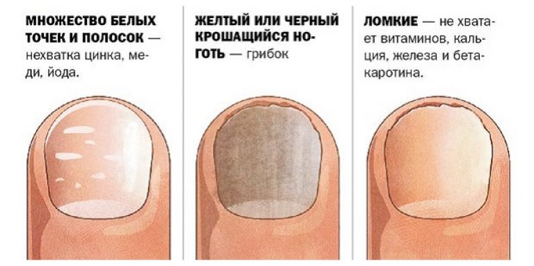 Почему после гель-лака ногти стали тонкие и мягкие