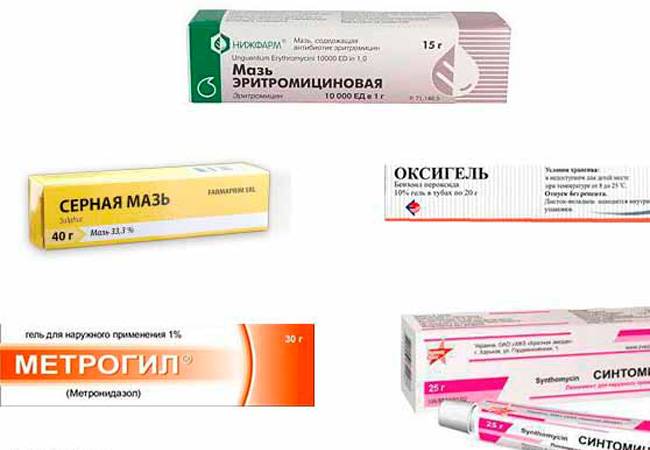 Прыщи на попе — причины и лечение