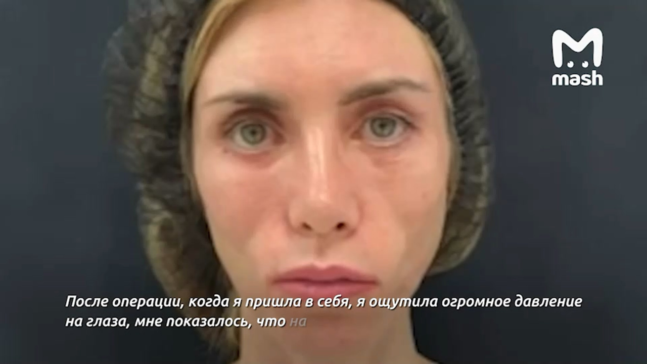 Пластическая хирургия. омолаживающие операции