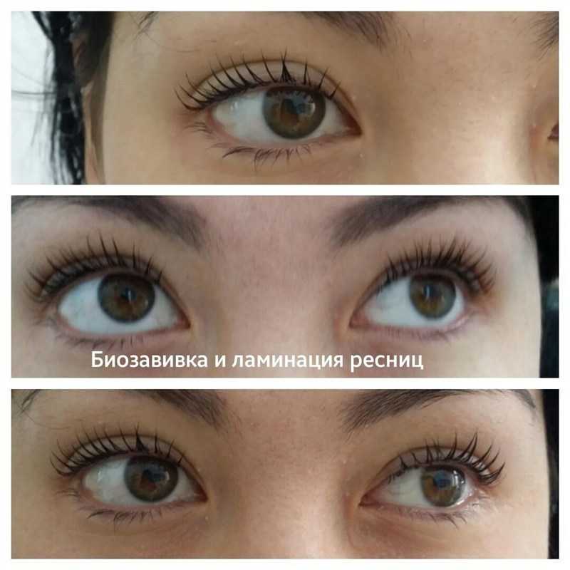 Что лучше: ламинирование или наращивание ресниц и через какое время можно делать