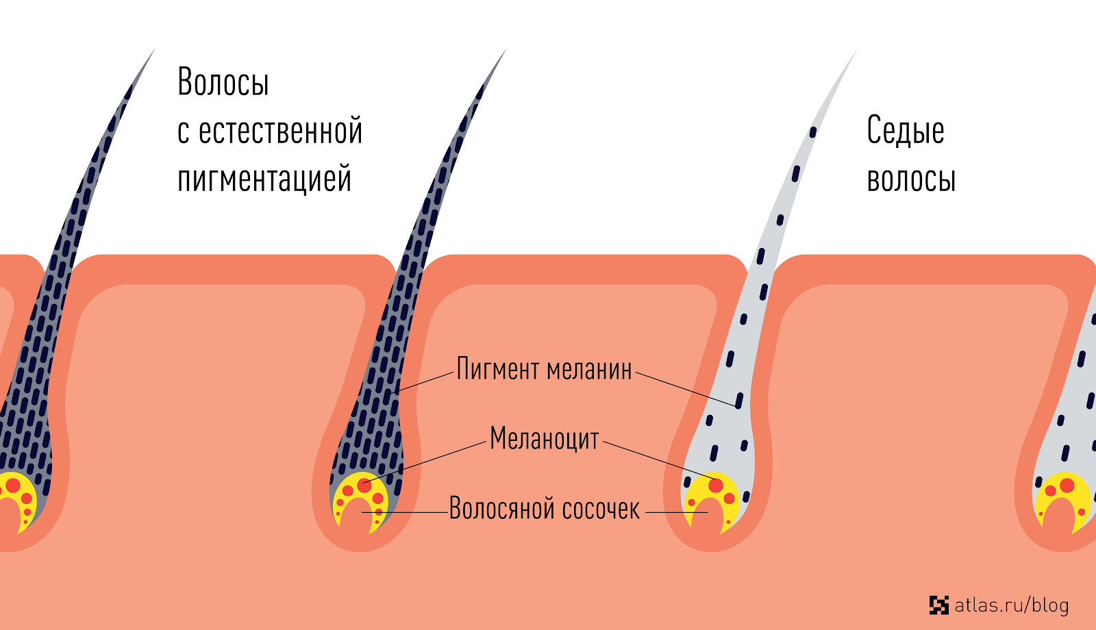 Есть кто седой? - страна мам