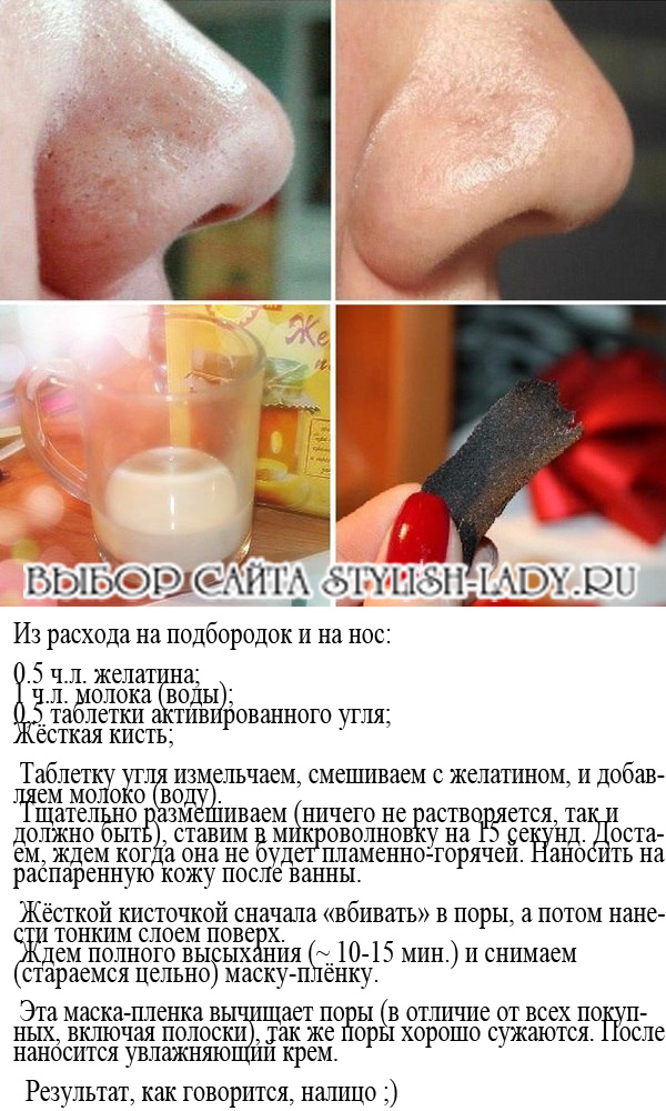 Черные точки на лице Причины появления и способы устранения Состав маски для лица Правила нанесения Топ лучших масок от черных точек из природных компонентов