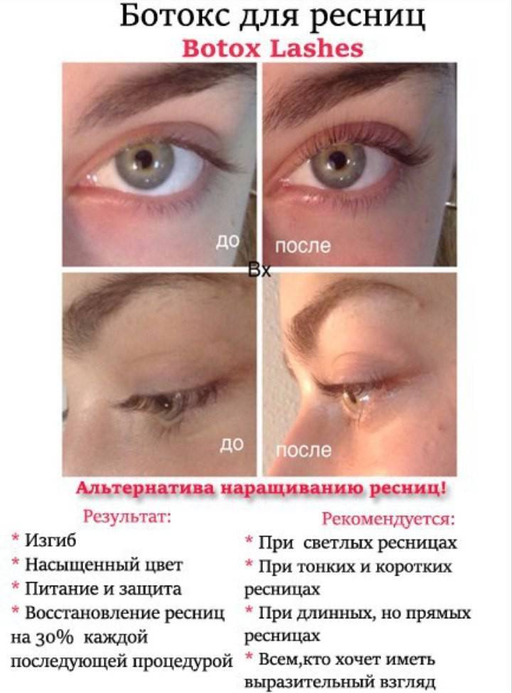 Что такое ботокс для ресниц и бровей: эффект от процедуры и отзывы с фото “до и после”
ботокс для ресниц и бровей - что это такое и чем отличается от ламинирования, отзывы об эффекте от процедуры с фото до и после