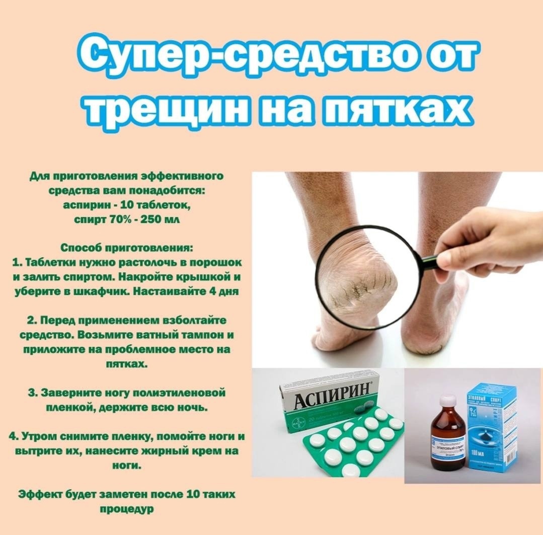 Если пятки потрескались и приобрели неприглядный вид, это легко исправить: вот что советуют сделать эксперты