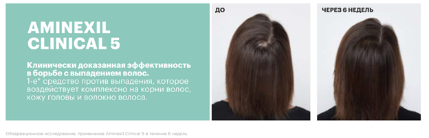Истончение и поредение волос – проблемы, которые можно решить