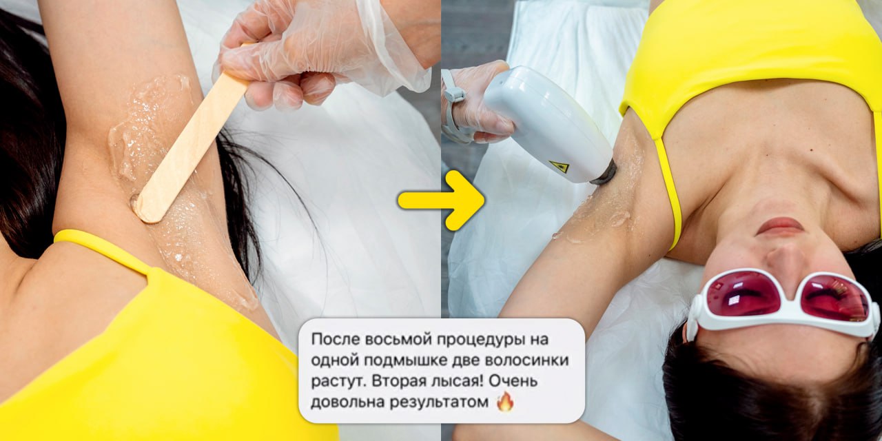 Как правильно побрить ноги: бритвой без раздражения, чтобы волосы долго не росли