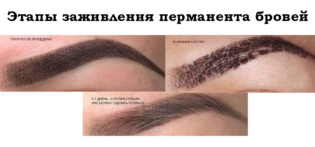 Не растут брови? топ-5 лучших средств
