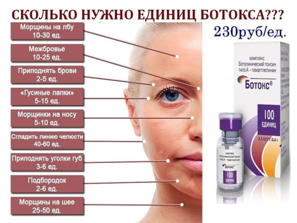 Ботокс для лица - плюсы и минусы процедуры, отзывы, противопоказания к уколам ботокса