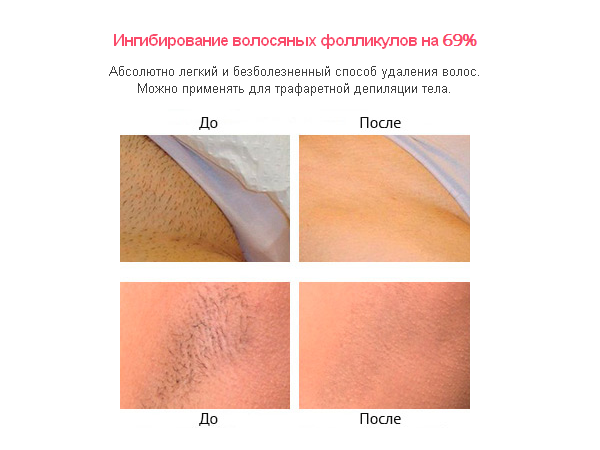 10 хитростей для тех, кто бреет ноги: как сделать их гладкими надолго