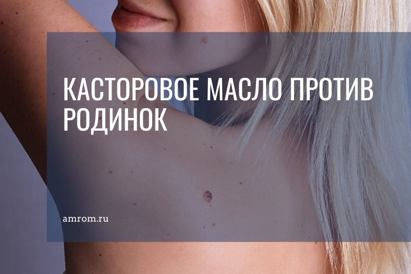 Родинки на теле девушки это красиво