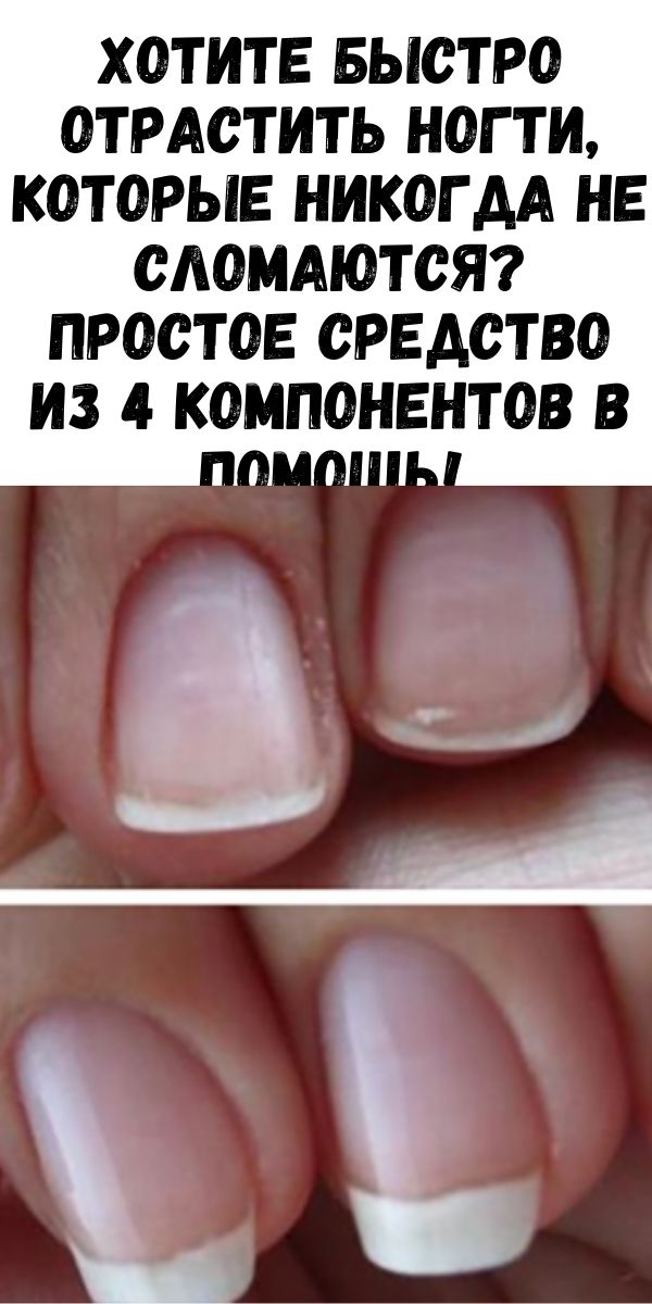 Как отрастить ногти за 7 дней