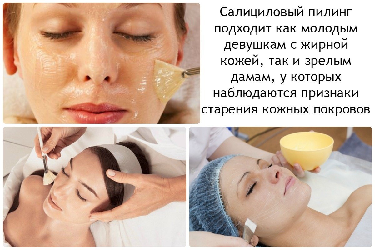 Чистка лица хлоридом кальция: показания, техника проведения