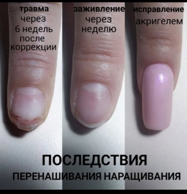 Как продлить жизнь маникюру гель-лаком