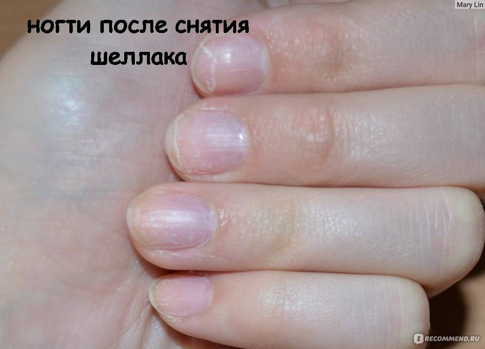 Действительно ли вреден гель-лак для ногтей