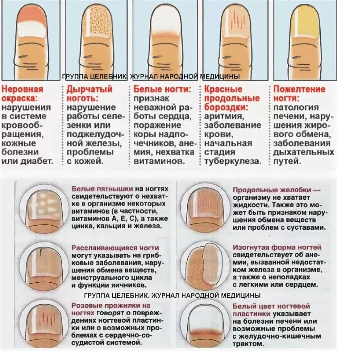 Проблемы с ногтями и как их лечить