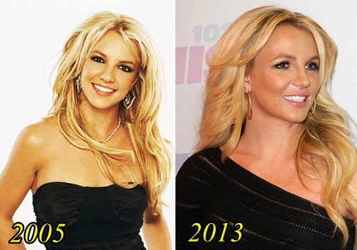 Britney spears plastic surgery: boob job, nose job, facelift