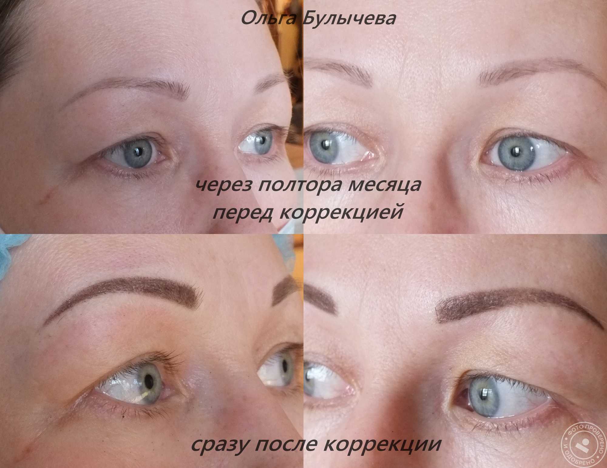 Неудачный татуаж бровей. фото до и после, как исправить с растушевкой и без, что делать, последствия