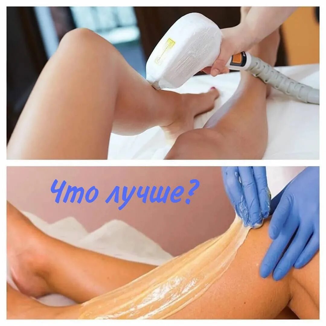 Qool эпиляция - отзывы клиентов, стоимость процедуры удаления волос